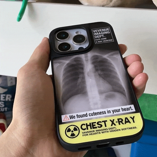 X-Ray iPhone Case with Hidden Dog or Cat