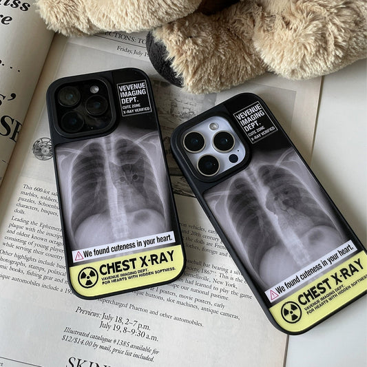 X-Ray iPhone Case with Hidden Dog or Cat