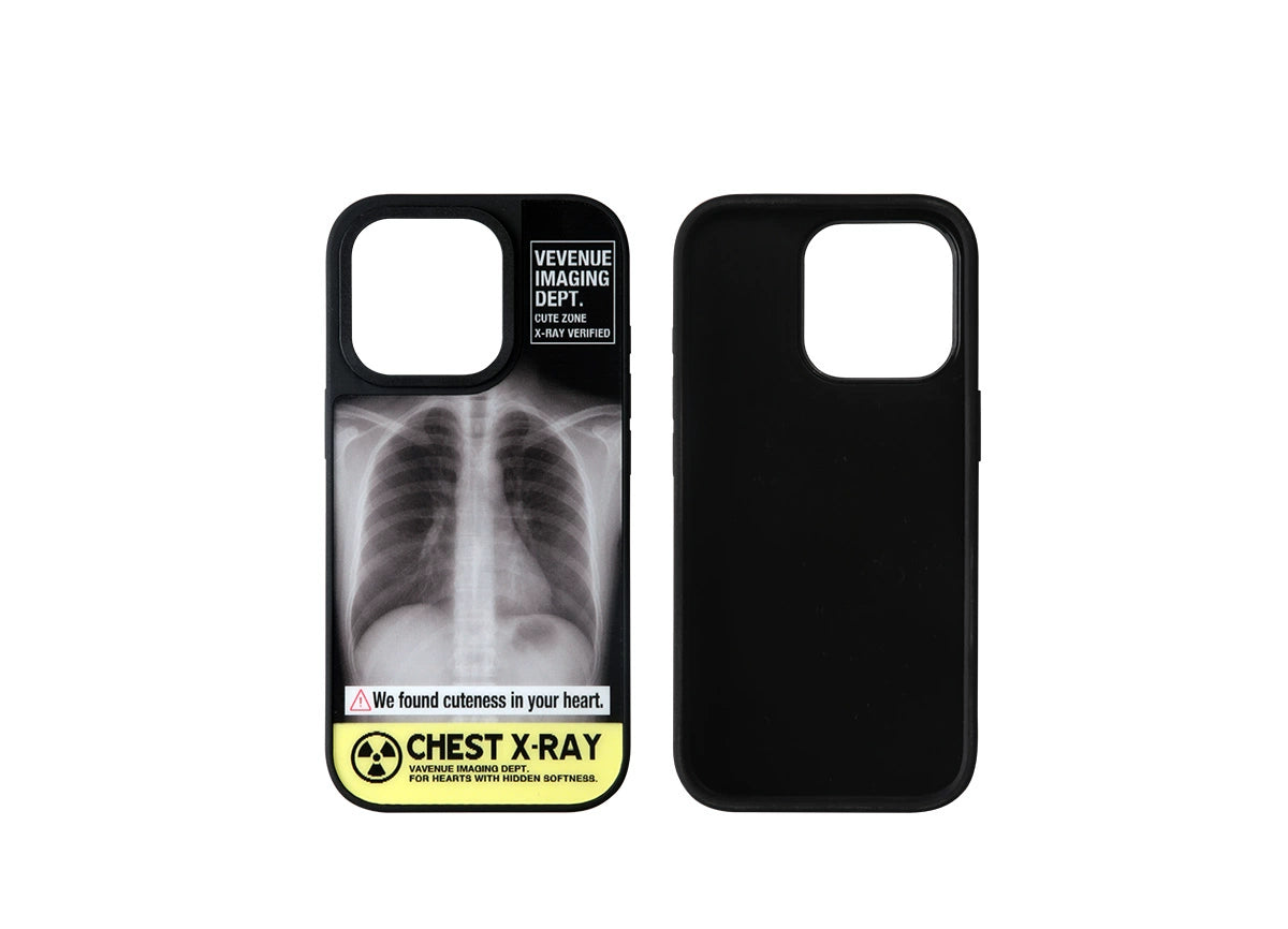 X-Ray iPhone Case with Hidden Dog or Cat