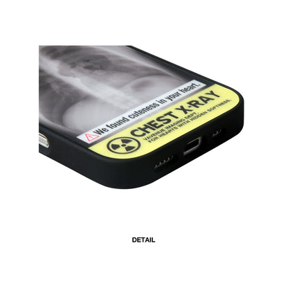 X-Ray iPhone Case with Hidden Dog or Cat